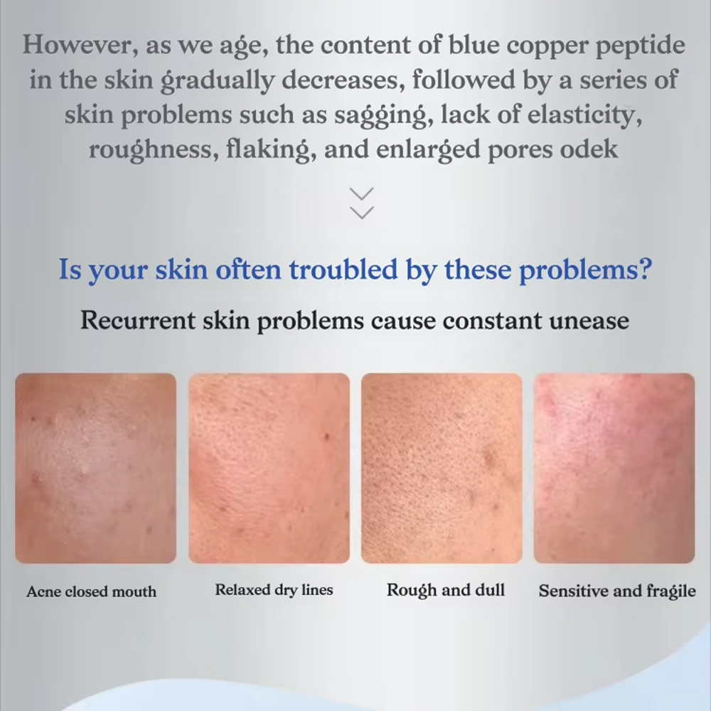 Blue Copper Peptide GHK-Cu Fre - Oligopeptide Wrinkle 리뷰 및 가격