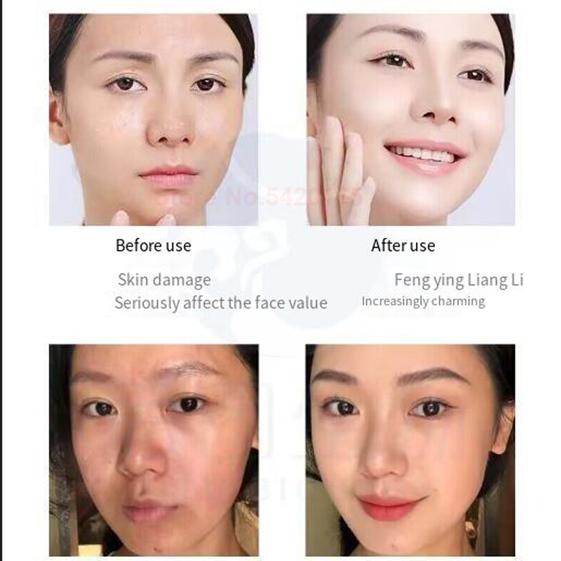 98% Blue Copper Peptide Freeze - Oligopeptide Wrinkle 리뷰 및 가격