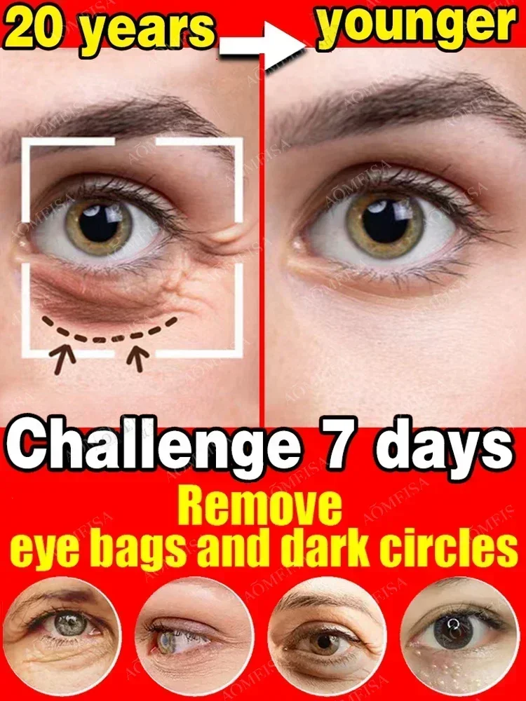 New 7 Day Tighten Wrinkles Eye - Oligopeptide Wrinkle 리뷰 및 가격