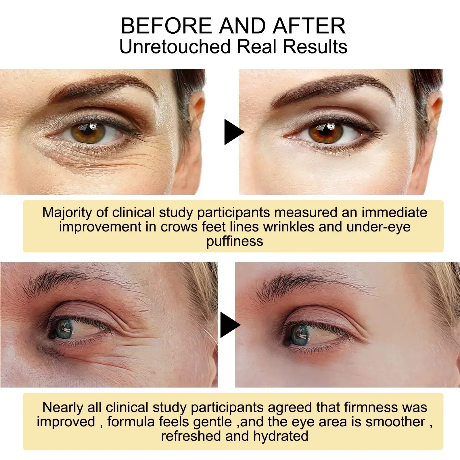New 7 Day Tighten Wrinkles Eye - Oligopeptide Wrinkle 리뷰 및 가격